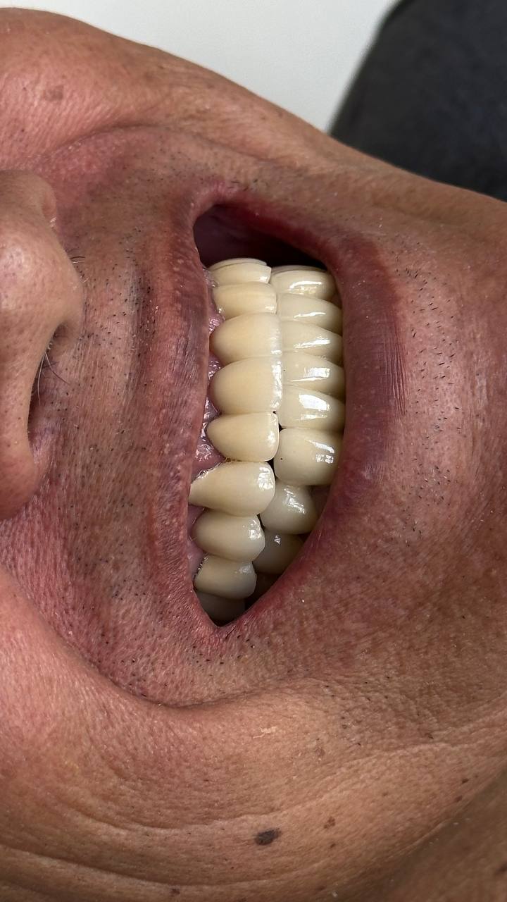 После лечения