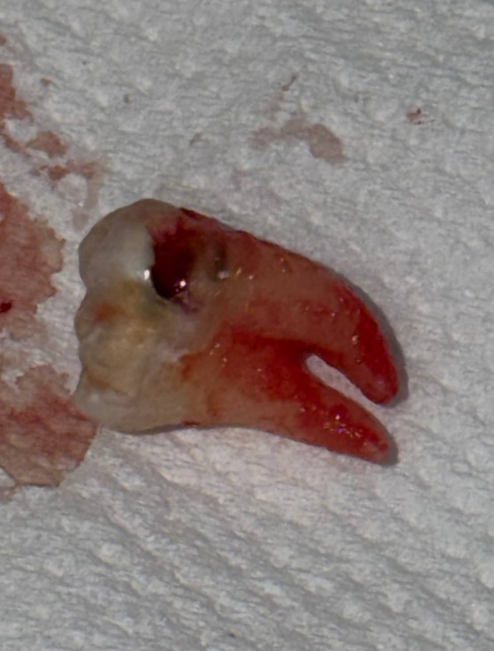 После лечения